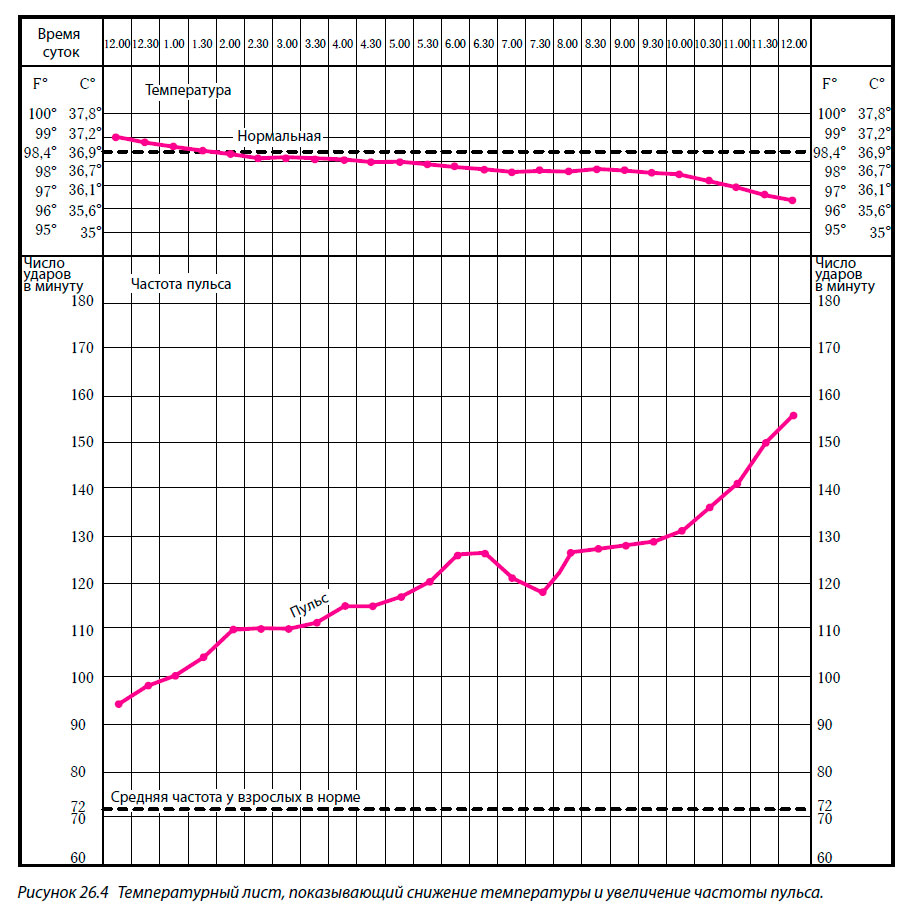 Температурный лист, показывающий снижение температуры и увеличение частоты пульса