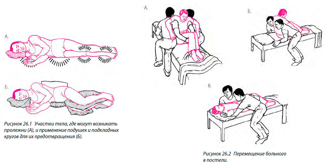 Участки тела, где могут возникать пролежни и Перемещение больного в постели. 